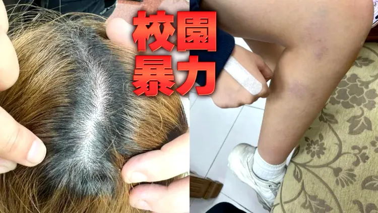 学长情绪失控，竟在校内拖行学妹，导致对方身心受创。翻摄我是新庄人许明伟脸书