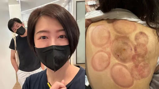 8 点档女星紧急入院开刀！秀「最美记号」　老公不舍一路陪伴