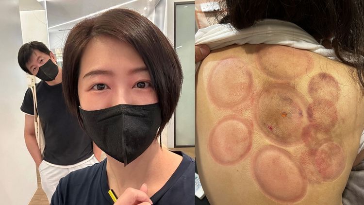 8 點檔女星緊急入院開刀！秀「最美記號」　老公不捨一路陪伴