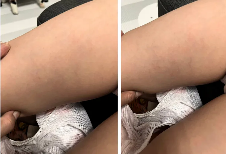 北市某特教幼兒園爆出教保員不當管教學童，家長氣憤報警，教育局介入調查中。林延鳳議員辦公室提供