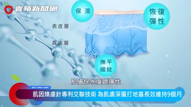 穩定又有效，肌因煥膚針可維持長達9個月。