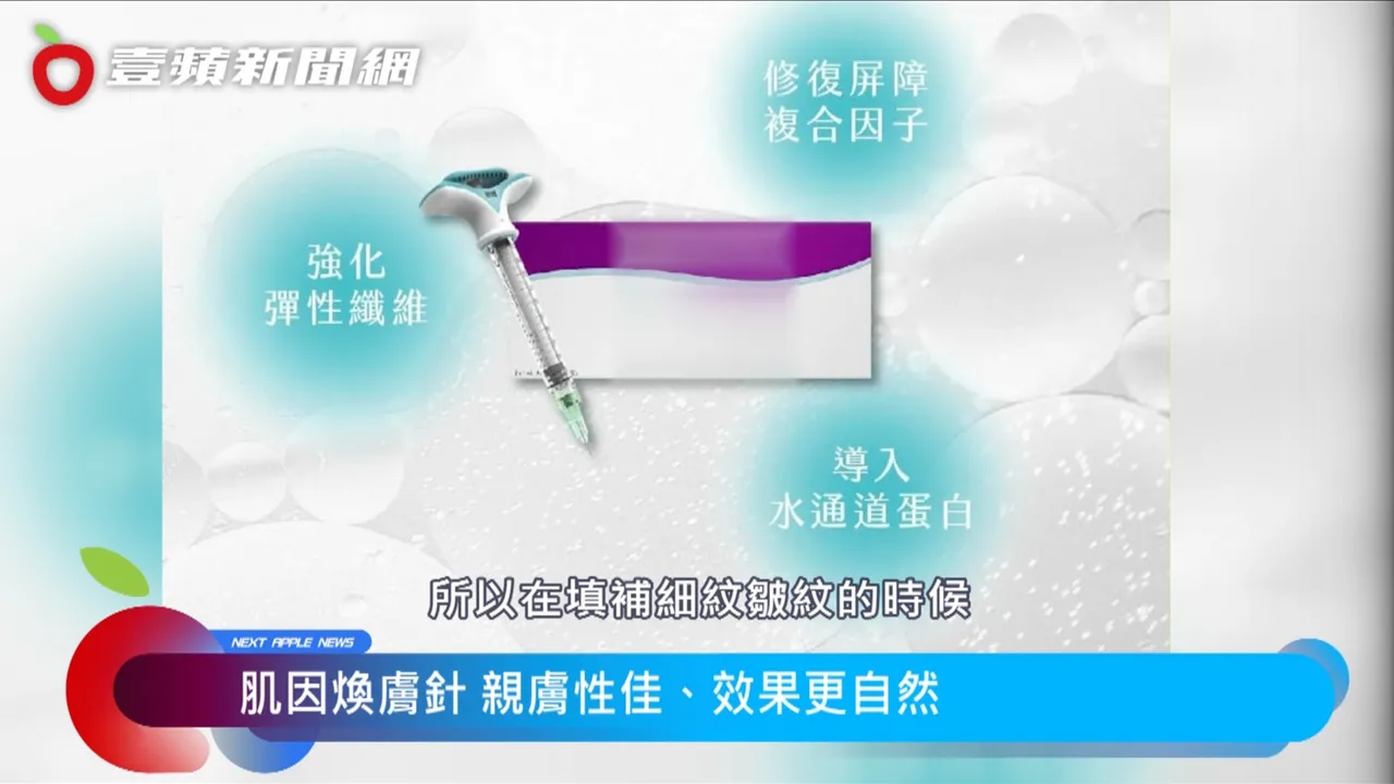 肌因煥膚針一次就能解決肌膚暗沉、粗糙、缺乏彈性、細紋等4大問題，且施作疼痛感適合怕疼又想要追求美的消費者。