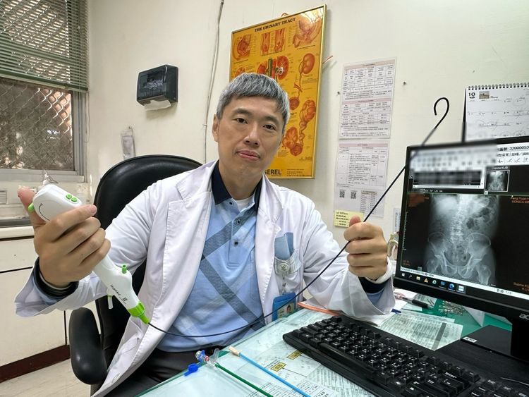 傳產老董「咖啡尿」驚見1.8公分結石 雷射碎石手術救腎保命