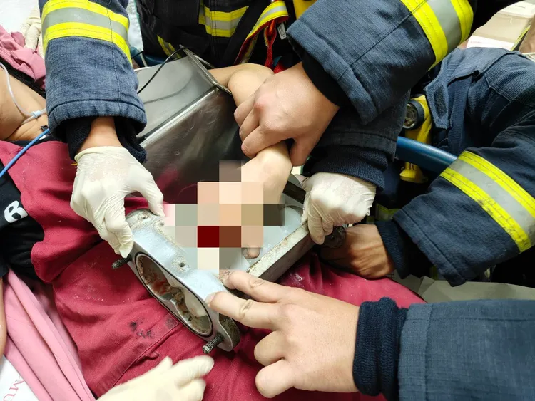 消防人員拆卸大部零件，將手部卡住的部分一起送往醫院處理。翻攝照片