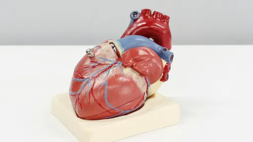 「多装1个心脏支架多活10年」　他听医师话一次装6个然后就死了