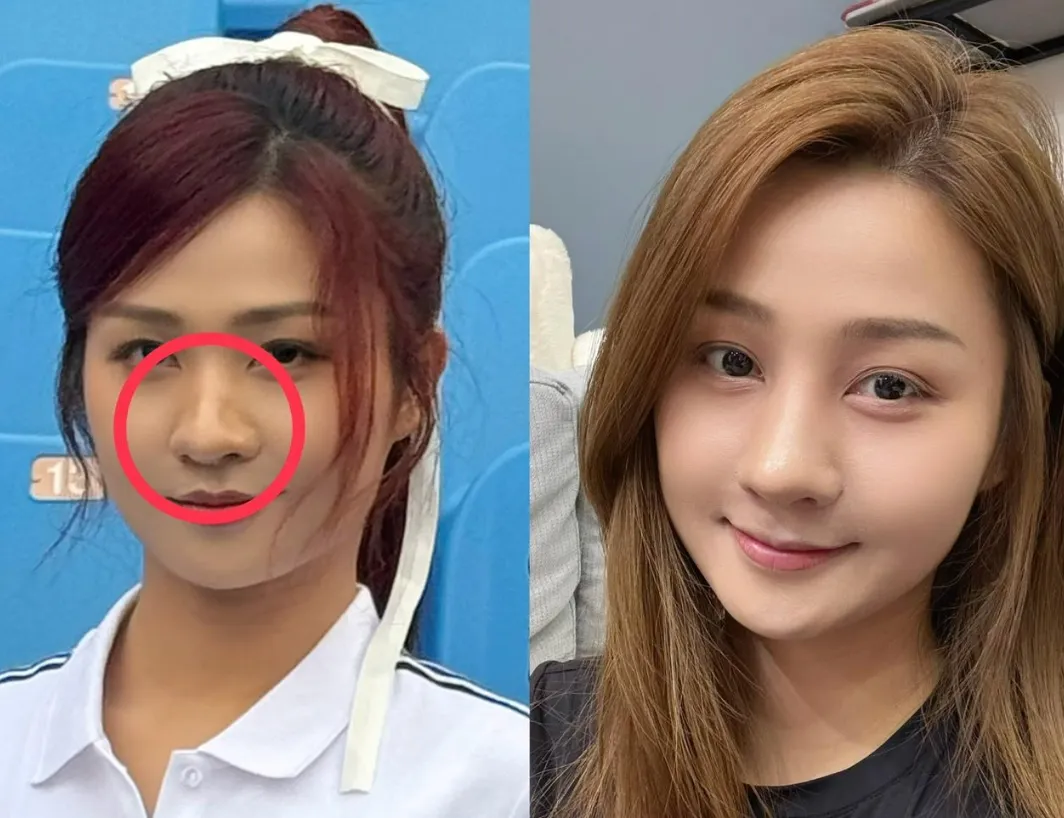 左图为二月拍广告画面，右图为小紫术后照片。乐天桃猿提供