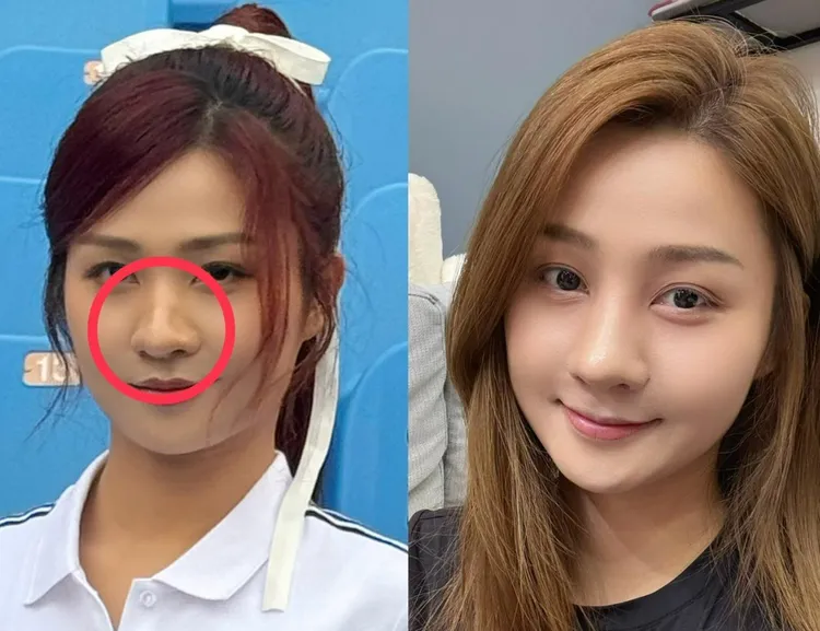 左圖為二月拍廣告畫面，右圖為小紫術後照片。樂天桃猿提供