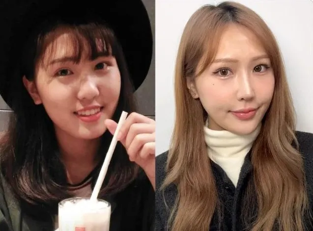 萧伊曾分享以前婴儿肥照片，后来变成韩系美人。翻摄萧伊Threads