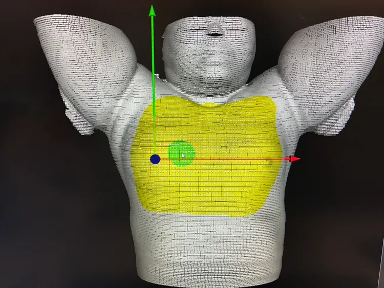 銳視刀搭配使用適應性放射治療，療程前會先接受電腦斷層模擬定位影像掃描。童綜合醫院提供