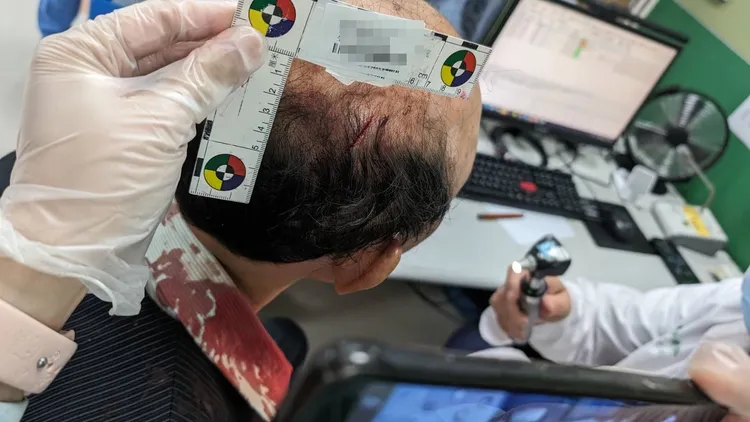 劉姓郵局經理被砍傷，衣領滿是鮮血。資料照片