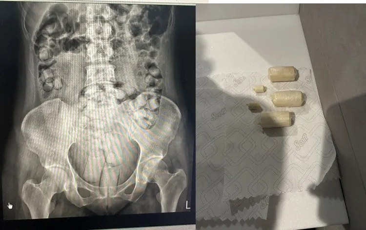 兩名泰籍女子以旅遊名義來台，卻被販毒集團以「空中飛人」手法當成運毒工具。海巡提供