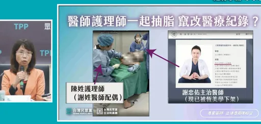 「恆美學」執刀醫謝忠佑遭控曾讓護理師違法抽脂　衛福部：已違醫師法