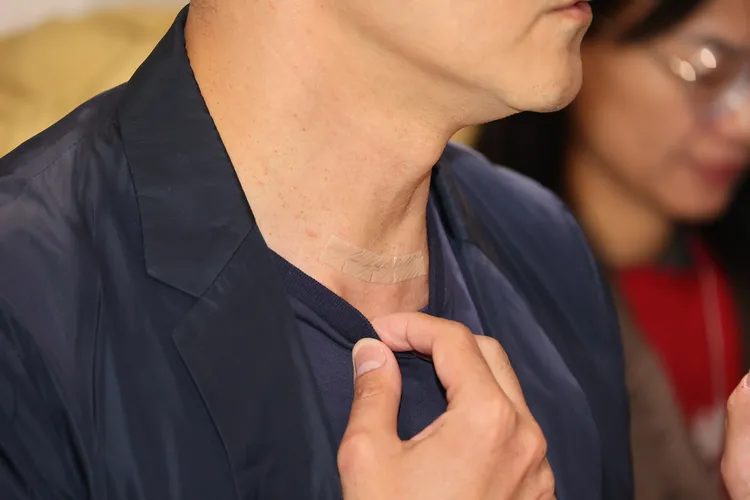 立威廉拉下衣領，秀出頸部橫的8公分的傷疤，上面貼有美容膠帶。特勤中心攝