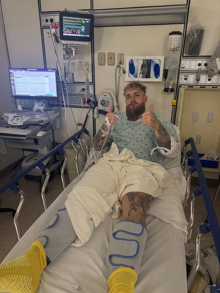 保羅開刀。保羅IG