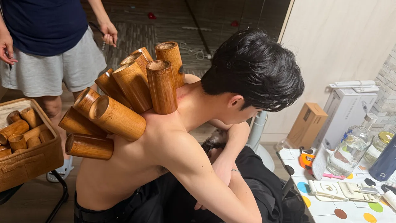 祈锦钥陪伴陈任佑拔罐，证明2人的好交情。祈锦钥提供