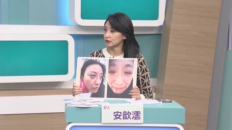 安歆澐出示被家暴照片。和展影視提供