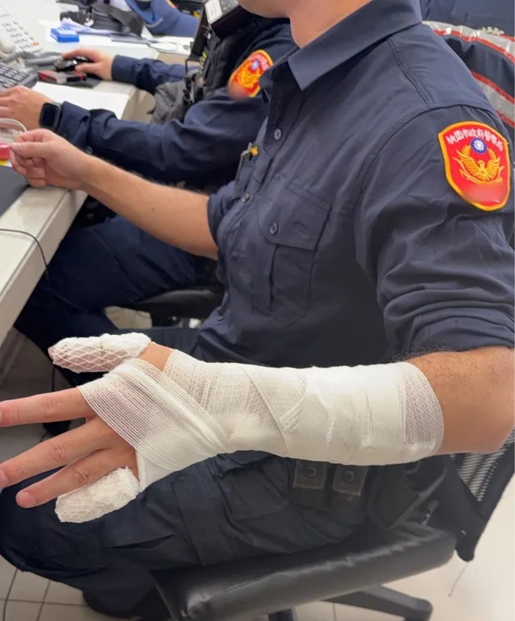 吳員手部遭割傷。中壢警分局提供