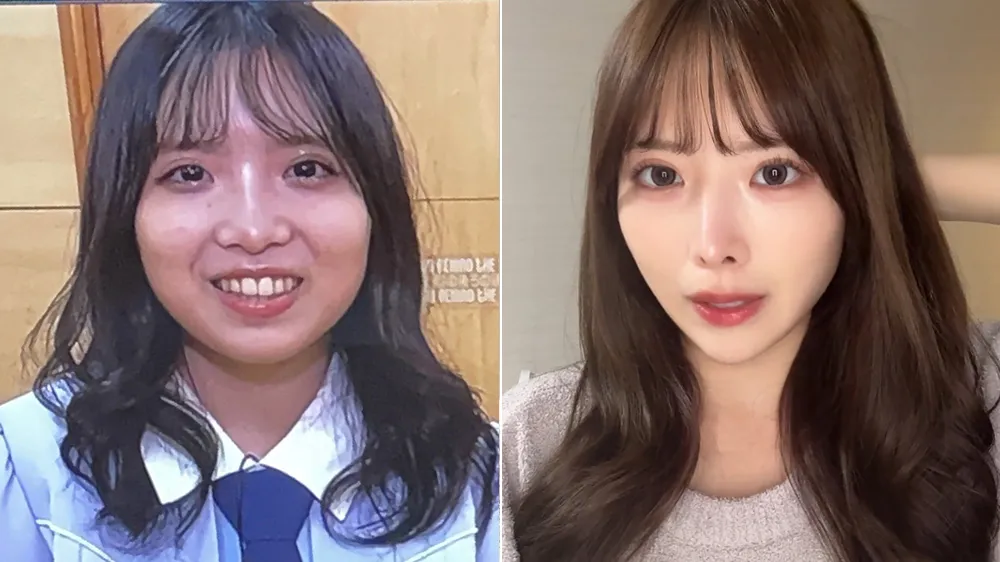 榊美优公布整容前后对比照引发热议。翻摄自榊美优X