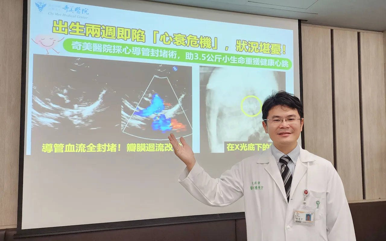 奇美醫院兒科部兒童心臟科主任陳俊宇表示，心導管封堵術為免開胸，術後更易復元。奇美醫院提供