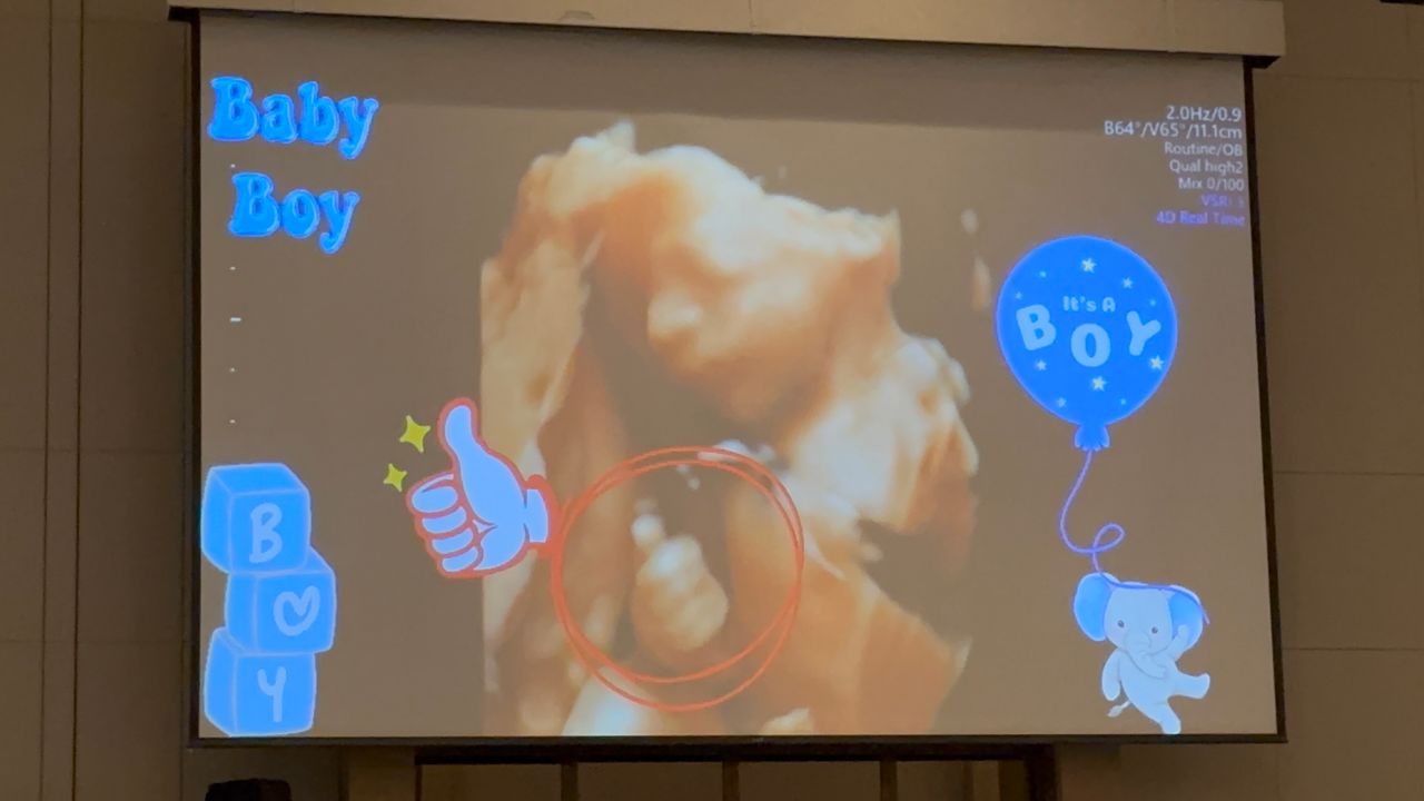 王齊麟小孩性別曝光!喜餅藏洋蔥 「十元」爆隱疾