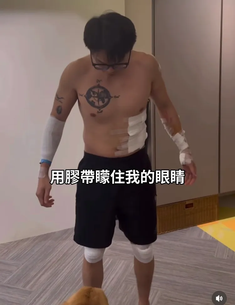 3名匪徒毆打陳昊又噴辣椒水，綁束帶後強擄上車，導致他全身多處傷痕。翻攝自陳昊IG