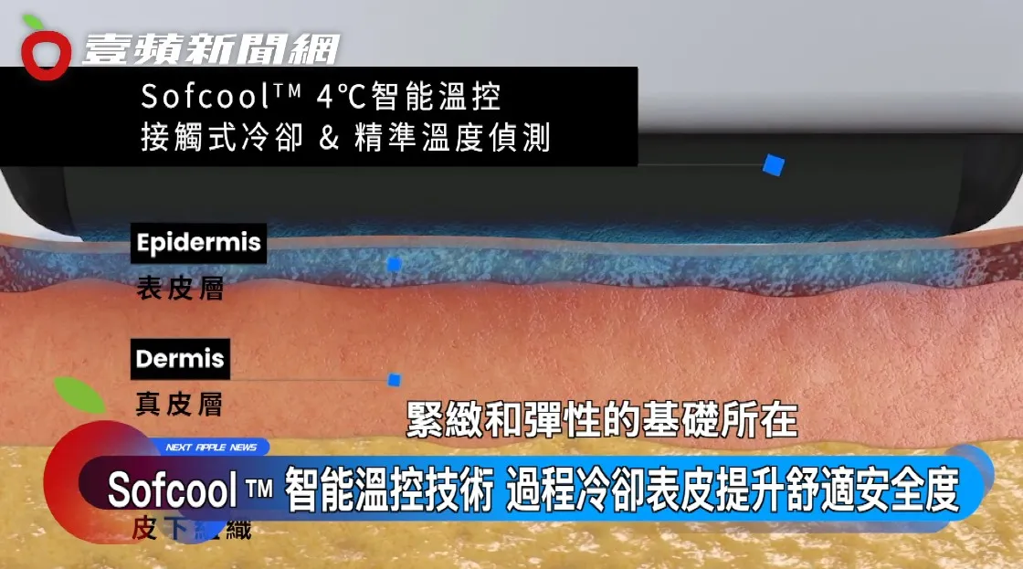 索夫波将能量精准作用在1.5 mm真皮层，能改善肤质、紧致肌肤、处理表面细纹。