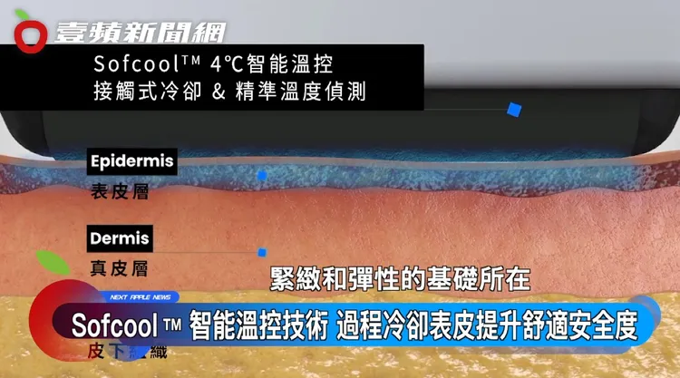 索夫波將能量精準作用在1.5 mm真皮層，能改善膚質、緊緻肌膚、處理表面細紋。