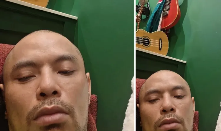 黃明志上周自拍光頭憔悴照後又秒刪。翻攝IG