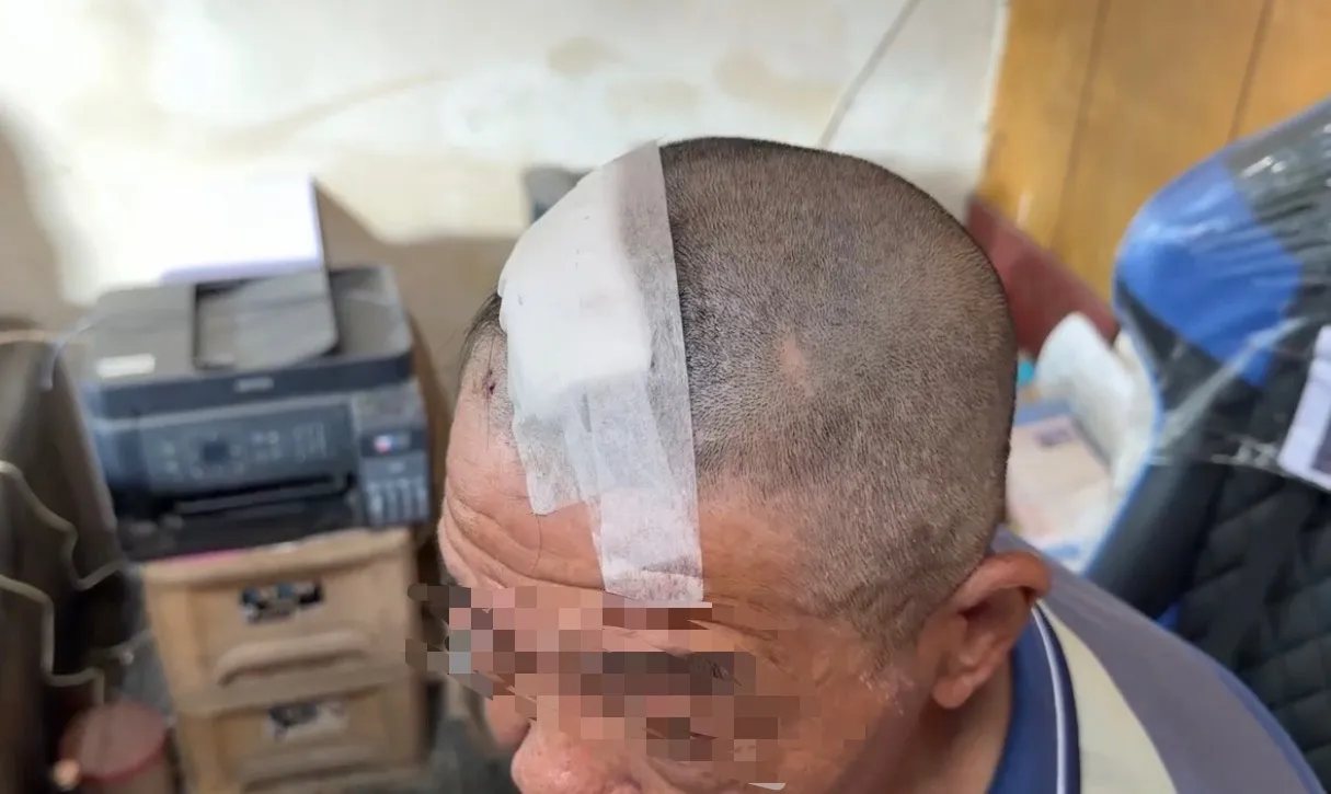 陈男头上缝了5针，中长发理成光头。民众提供