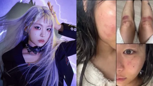 韩29岁女星公开被打瘀青照！控诉遭制作人男友持刀掐脖施暴