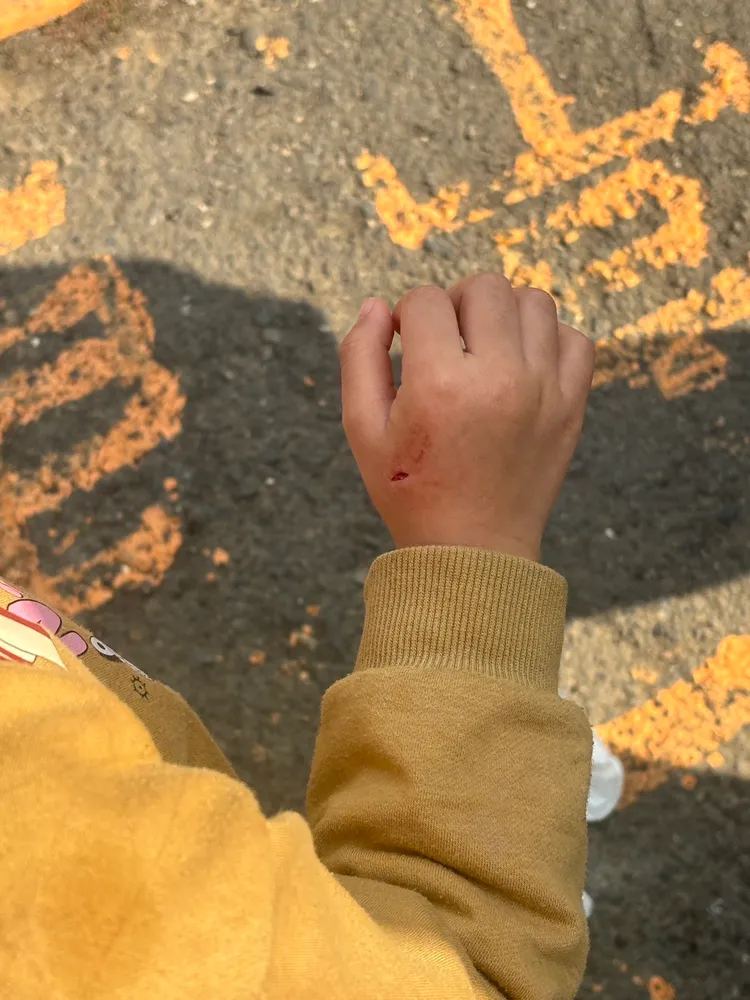 柴犬失控咬傷女童。翻攝畫面