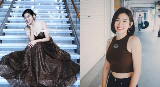 米可白殺青宣布開刀　每天頭痛動「切除神經手術」