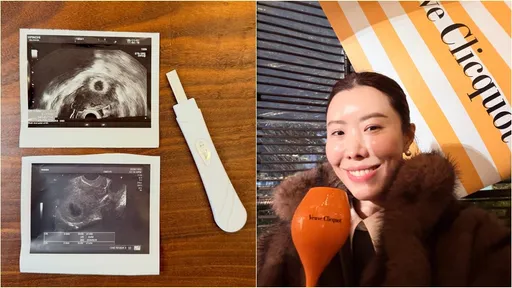 45歲金老佛爺流產淚別寶寶　「對不起讓你看不到光」