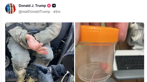 美國抗議民眾咬斷ICE手指　川普轉貼駭人畫面