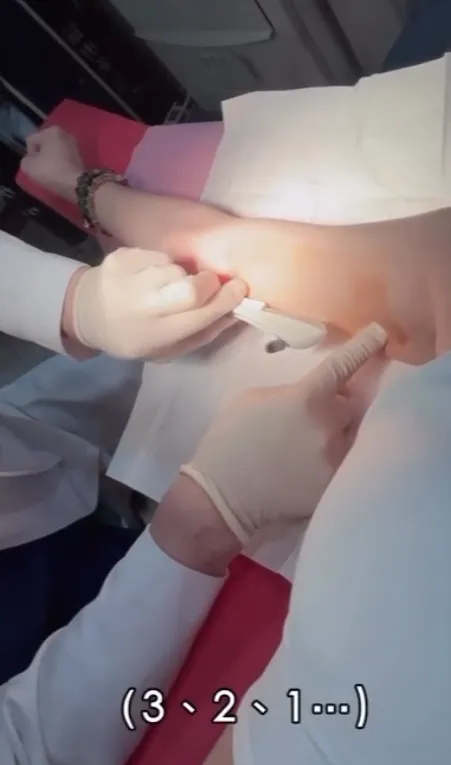 蔡允潔花20秒就做好3年的避孕工作。翻攝cindy10201020 IG