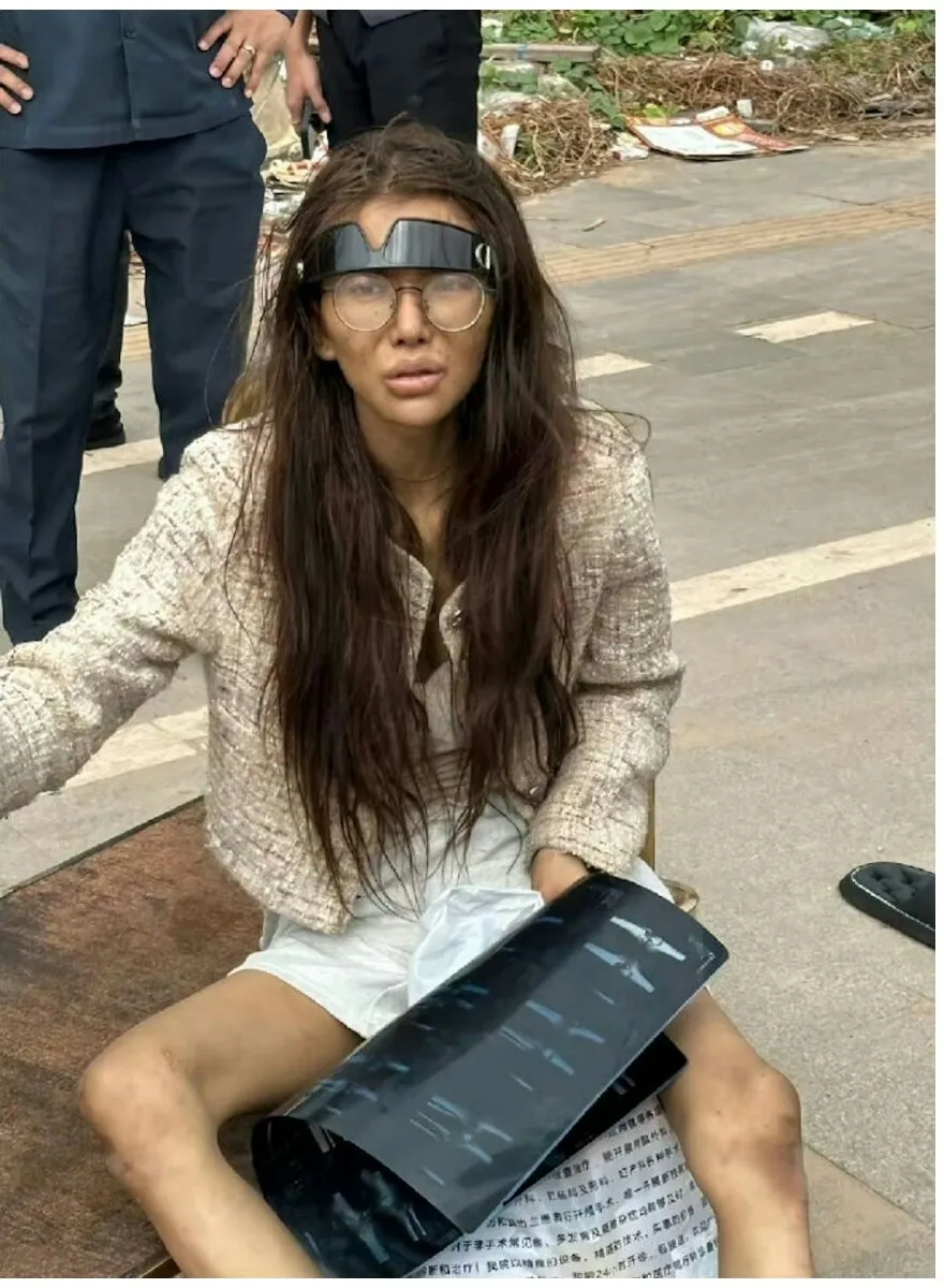 中国网红Umi模样凄惨。