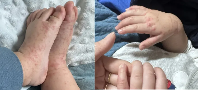 姊弟父母隱瞞疫情還讓孩子到校上課，害其他無辜幼童染疫。讀者提供