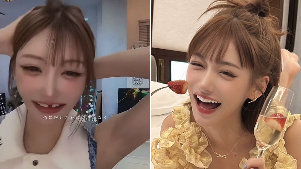 明日花綺羅「門牙少一顆」賀年片漏風 醫師猜這原因害的