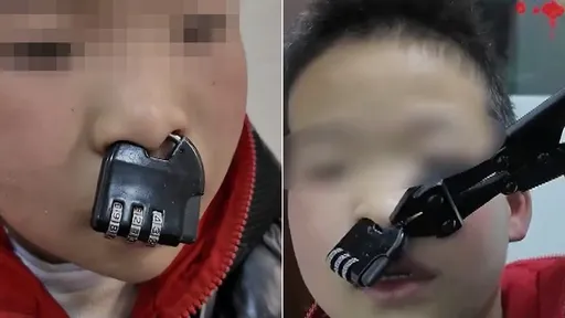 男童「密碼鎖鎖鼻子」求救　網笑噴：牛魔王怕鼻屎被偷？