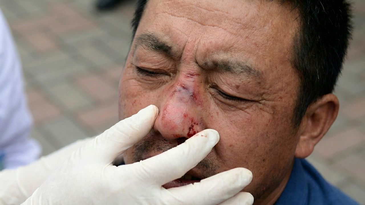 菜鳥廚師上班第一天「咬掉老鳥鼻子」 竟因爭執如何稱呼老闆