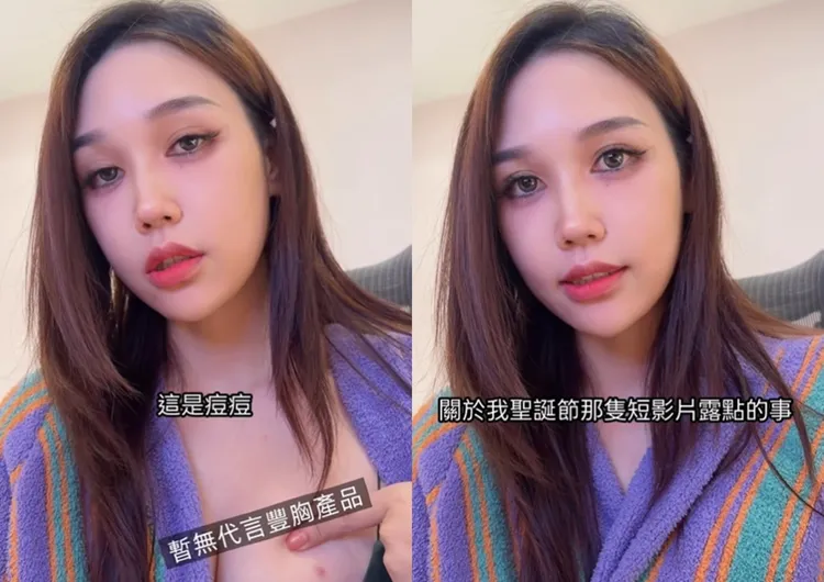 Ashly解釋自己是長痘痘，不是露點。翻攝Ashly IG