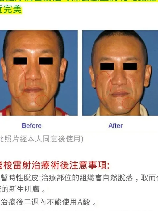 陳為民醫美照「打馬賽克也沒用」　全網笑翻：化成灰都認得