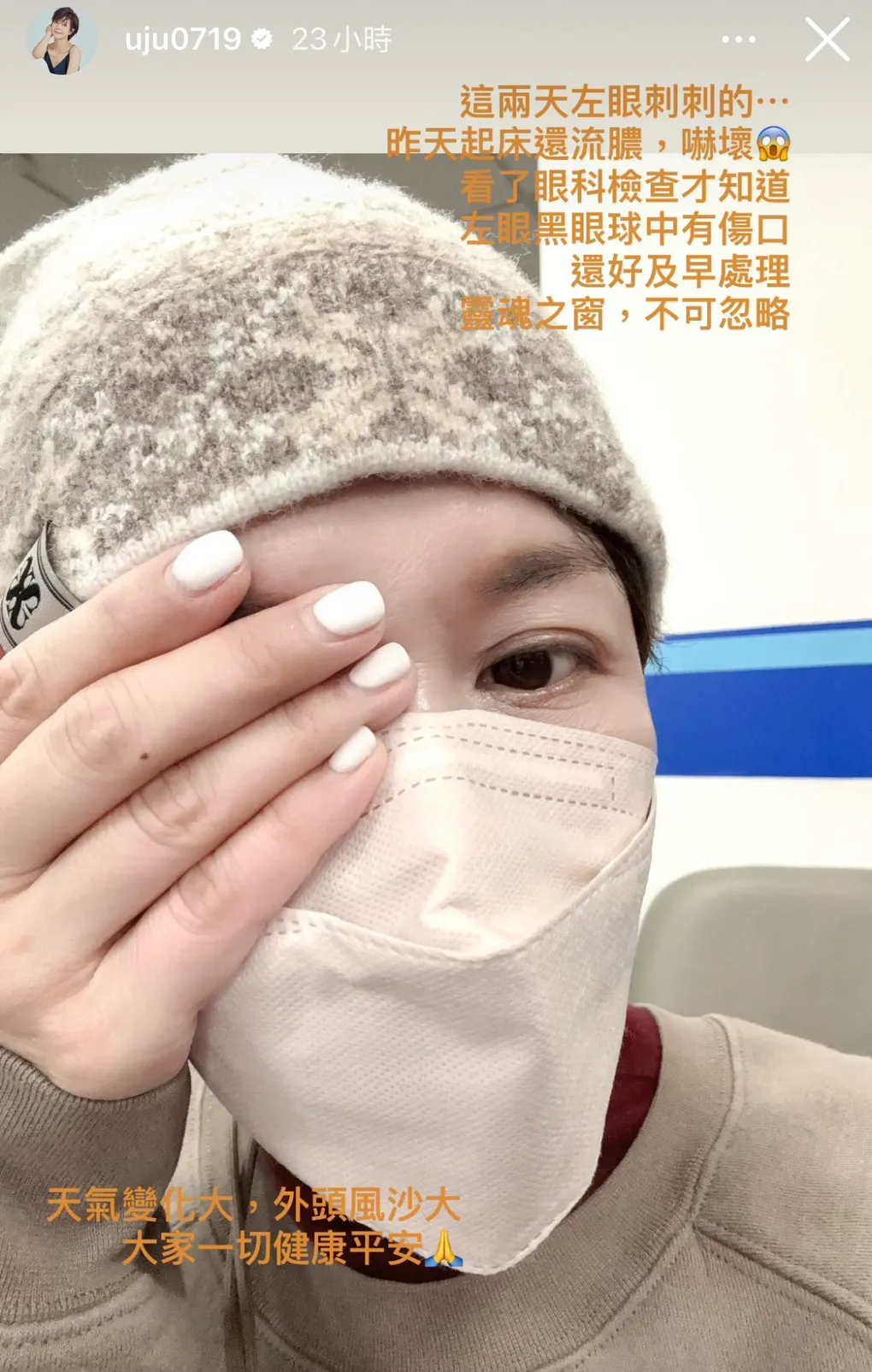 于子育眼球受伤了。翻摄自于子育IG