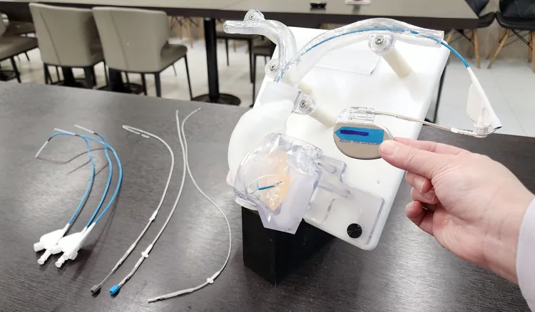 84歲老伯心跳一分鐘僅32下，幾乎「快停了」有猝死風險，生理性傳導節律器安裝後，身體恢復正常。院方提供