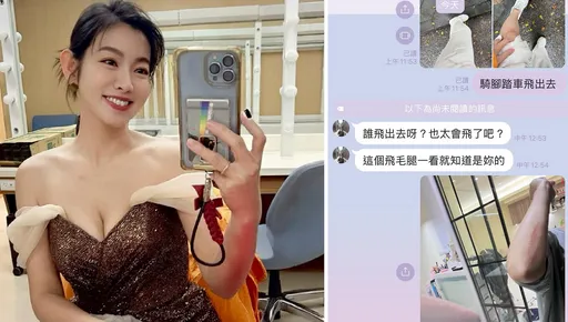 米可白天雨路滑騎車飛出去！傷勢照曝光　怨嘆「下雨天不宜出門」