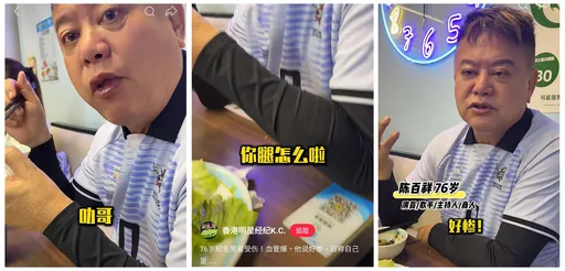 76歲港星驚曝「血管爆了」！大腿整片瘀黑嚇壞粉絲　親揭真相：場上太拚命