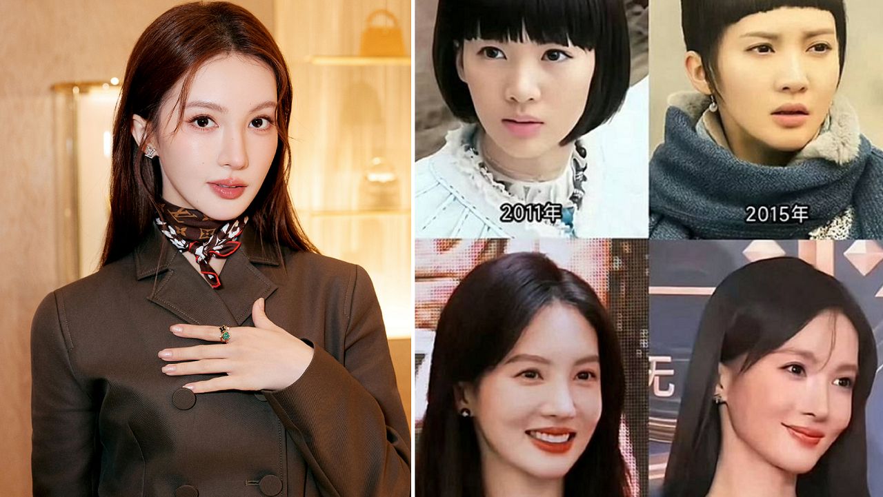 金晨車禍毁容動手術 15年顏值進化太驚人