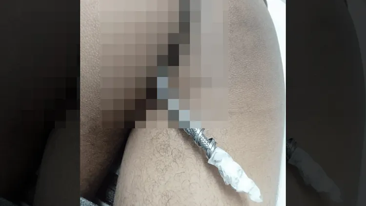 23歲男子連著部分水管到醫院求助。翻攝畫面