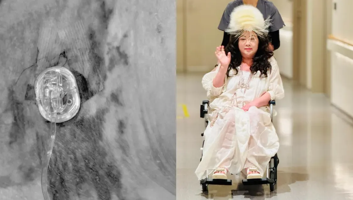 陳文茜罹患黑色素癌第四期，日前分享抗癌進度與照片。翻攝《文茜的世界周報 Sisy's World News》臉書