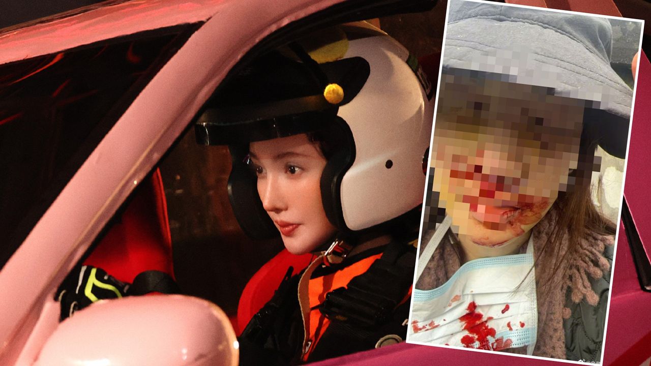 金晨撇肇逃安全下莊?助理「主動頂包」網揪3疑點